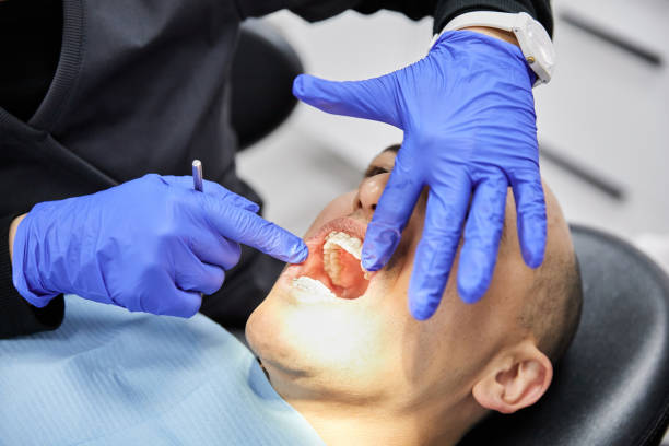 Best Emergency Dental Surgery in Leander, TX