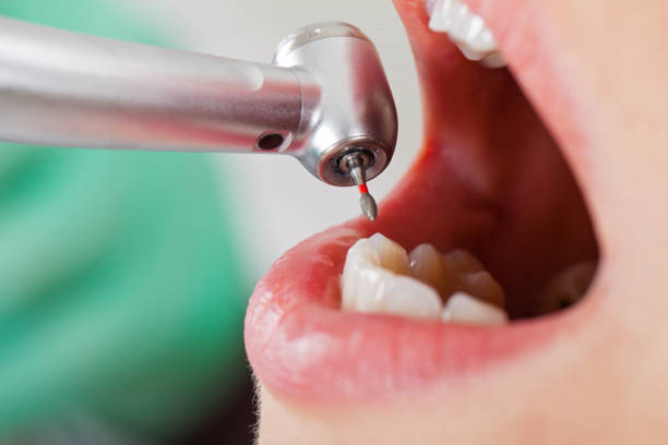 Best Emergency Treatment for Toothache in Leander, TX